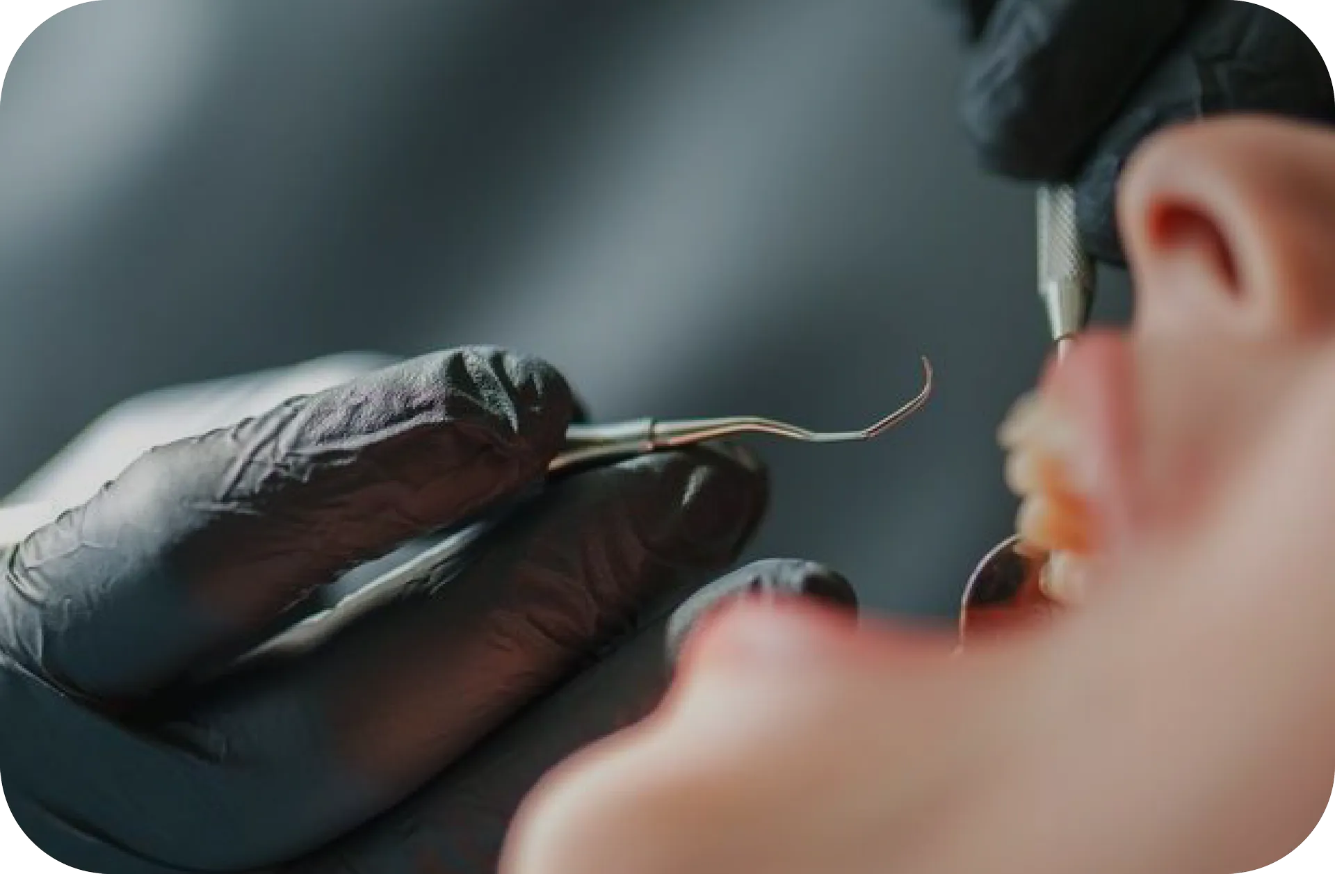 Oral Surgery