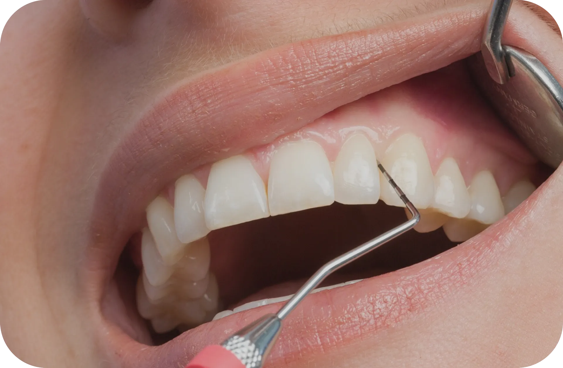 Periodontology