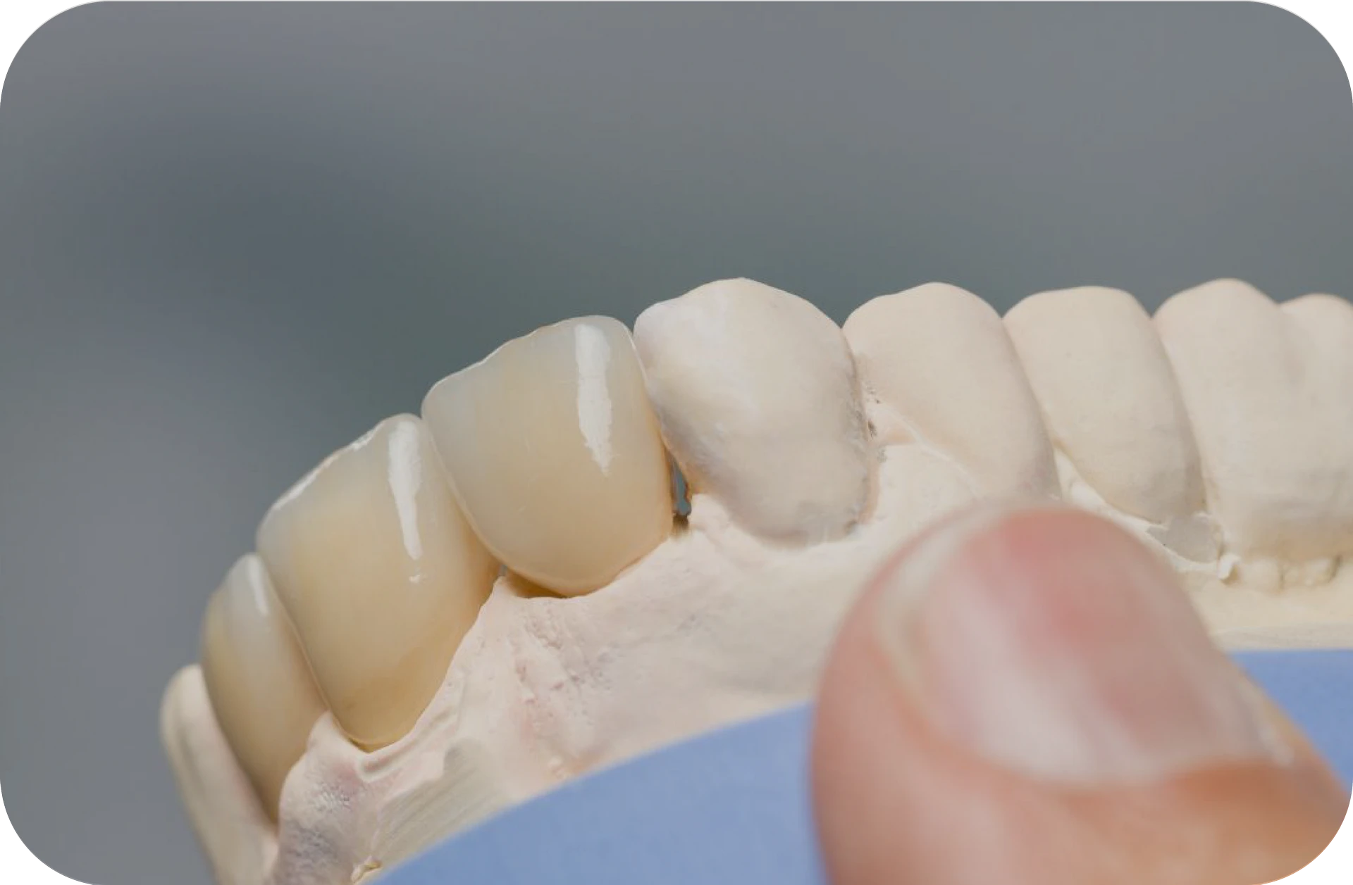 Implantology
