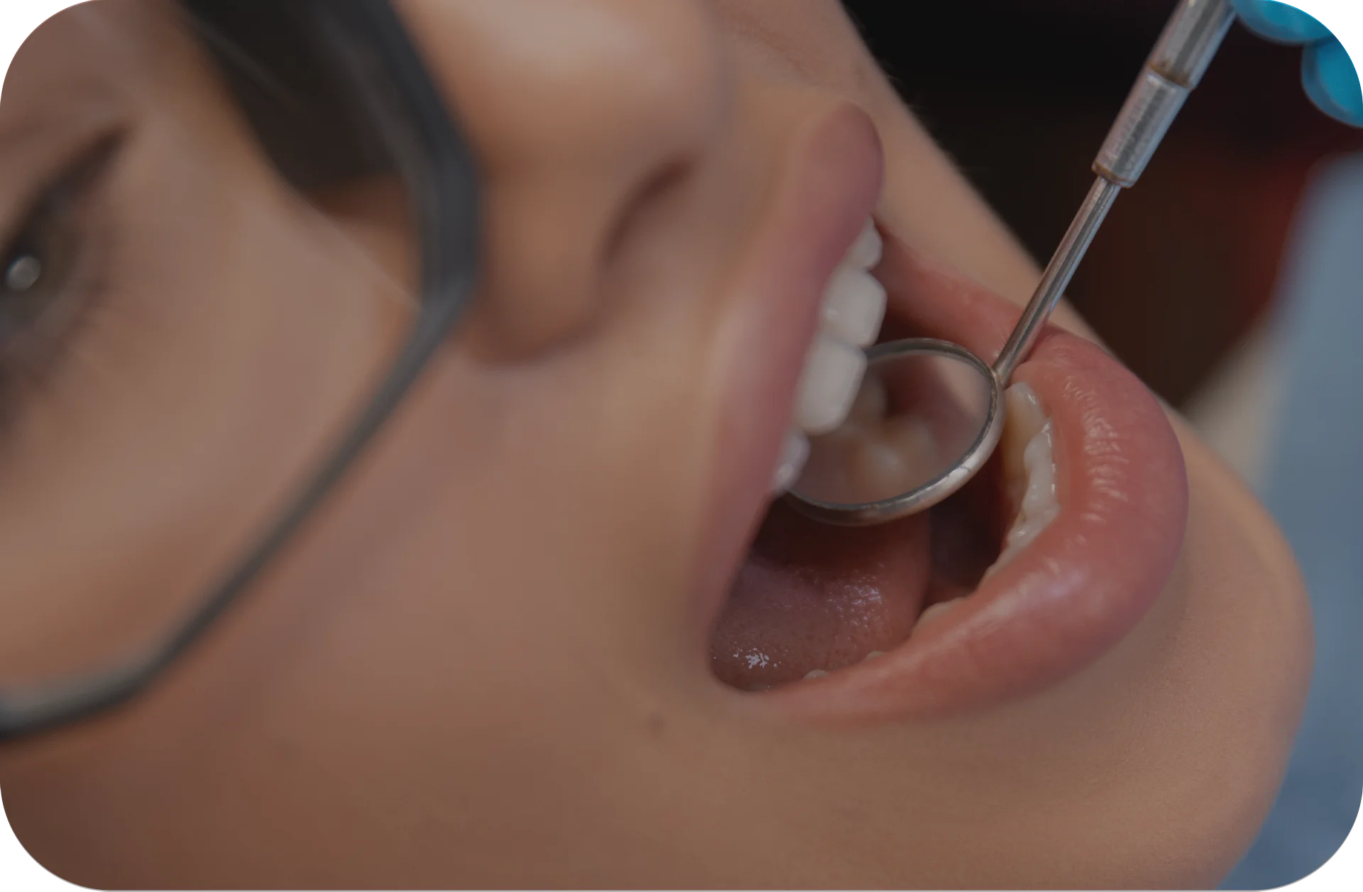 Conservative Dentistry