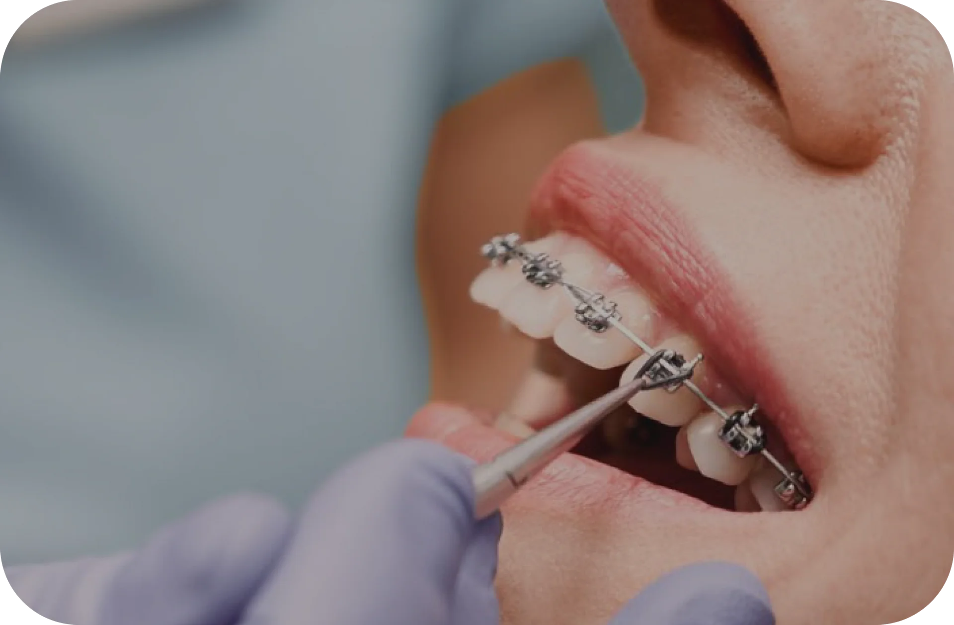 Orthodontics
