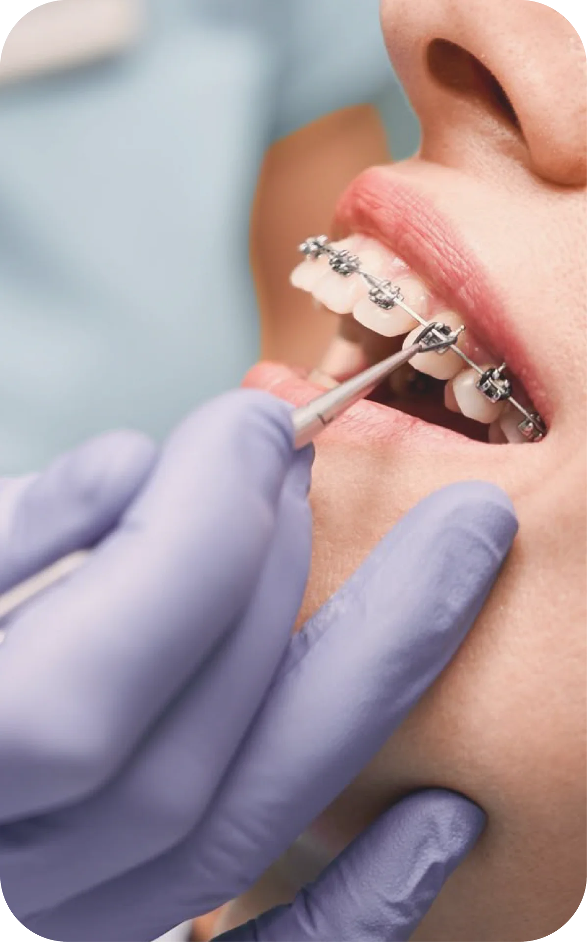 dentist adjusts fixed braces